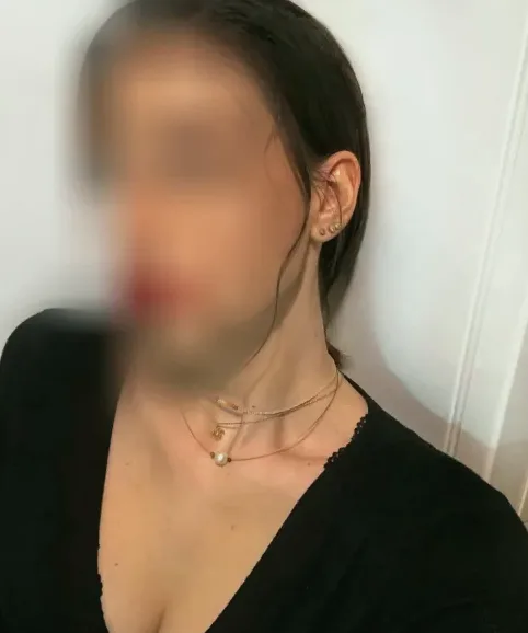 Malin, 25